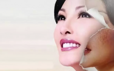 一年中最佳的祛斑時(shí)間，那無(wú)疑是秋季。