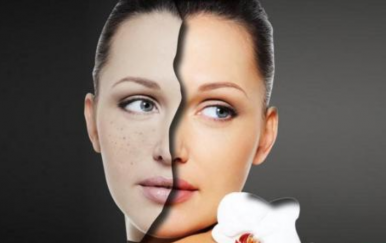 簡(jiǎn)單的祛痘方法，讓你的皮膚時(shí)刻光滑細(xì)嫩